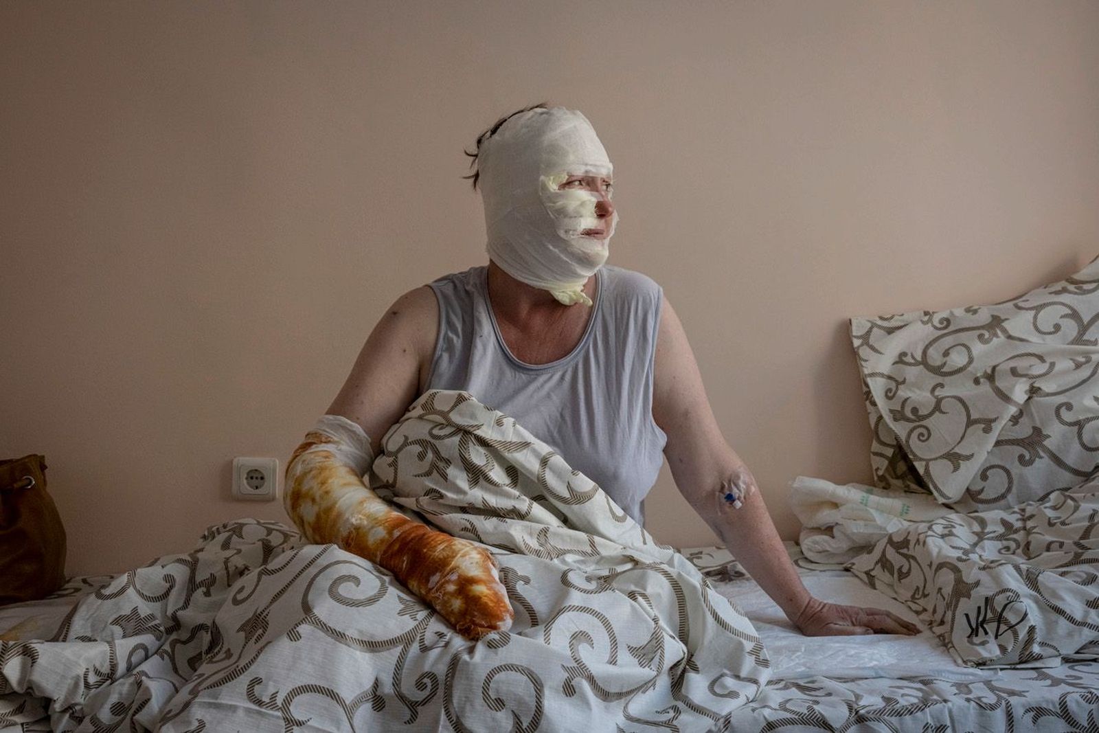Жительница Винницы Рина Волкова в ожоговом отделении больницы. Когда в центре Винницы упали три российские ракеты, Волкова находилась в клинике. В результате обстрела города 24 человека погибли, больше 100 получили ранения. 16 июля / Ed Ram / ZUMA Pr