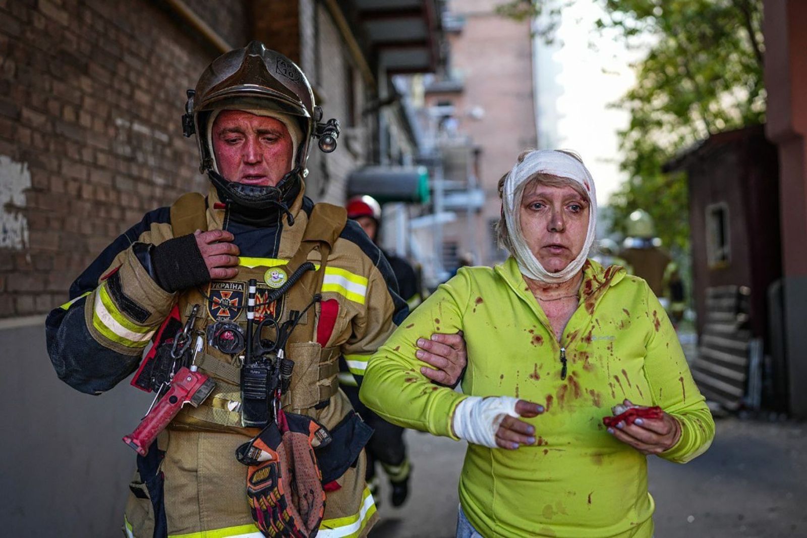 Украинский спасатель помогает местной жительнице, получившей ранения во время российского обстрела в Шевченковском районе Киева. 10 октября / Ukrainian State Emergency Service / Anadolu Agency / Getty Images / CNN