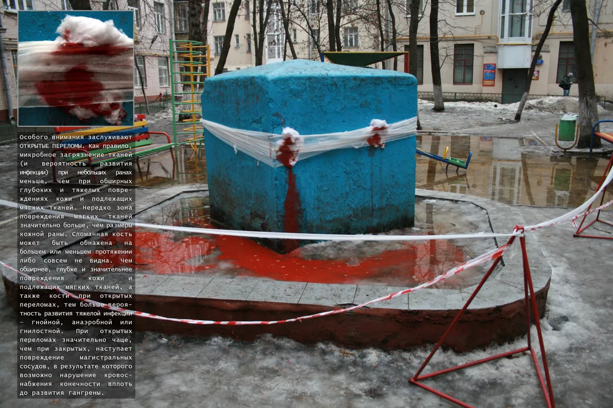 Больные места