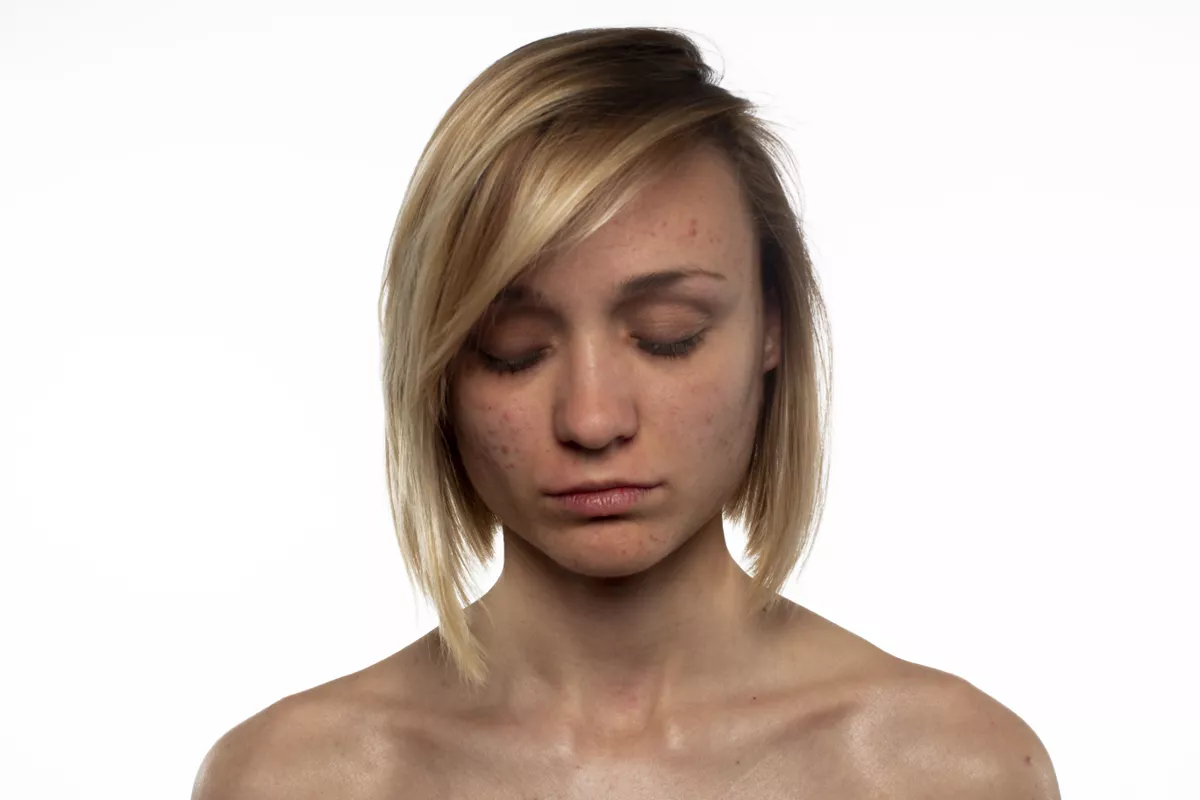 Стандарты красоты: оборотная сторона