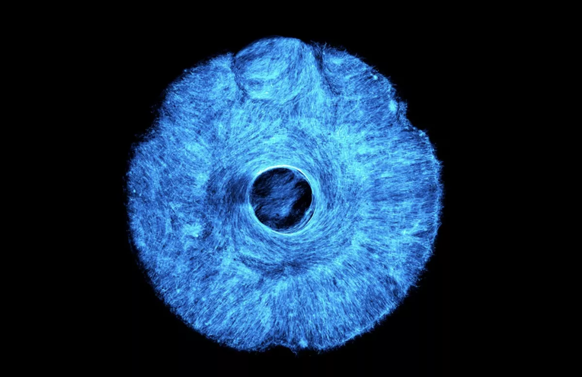 Инженеры Массачусетского технологического института (MIT) разработали метод выращивания искусственной мышечной ткани, которая координированно сокращается в разных направлениях, имитируя работу радужной оболочки глаза / Фото: Massachusetts Institute of Technology