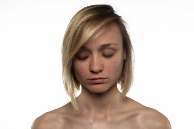 Стандарты красоты: оборотная сторона